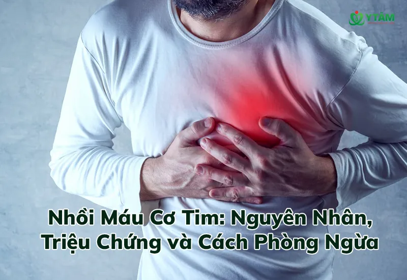 Nhồi Máu Cơ Tim: Nguyên Nhân, Triệu Chứng và Cách Phòng Ngừa